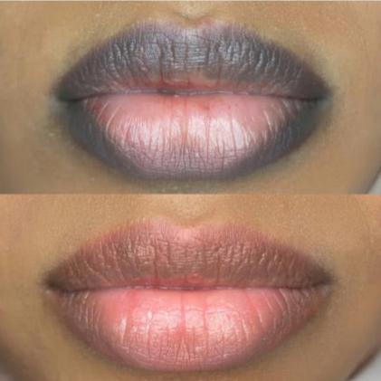 NEW: Online Lip Neutralization Tattoo Training